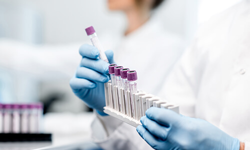 Offering Platelet-Rich Plasma